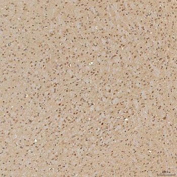 SINHCAF Antibody