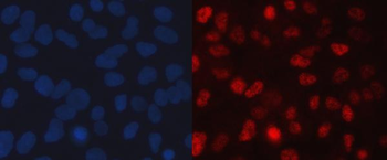 SINHCAF Antibody