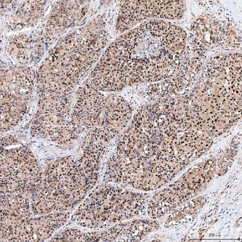 SINHCAF Antibody