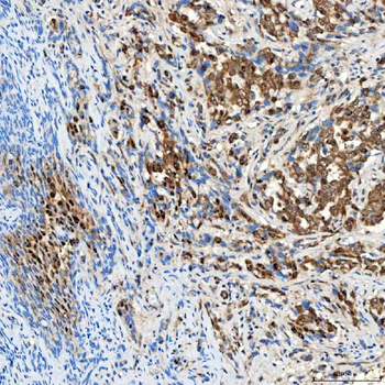 SINHCAF Antibody