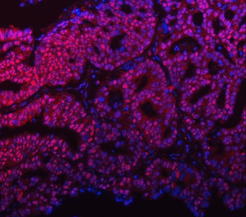 mSin3A/SIN3A Antibody