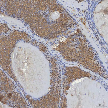mSin3A/SIN3A Antibody