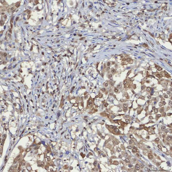 mSin3A/SIN3A Antibody