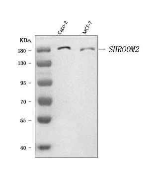 SHROOM2 Rabbit Polyclonal Antibody