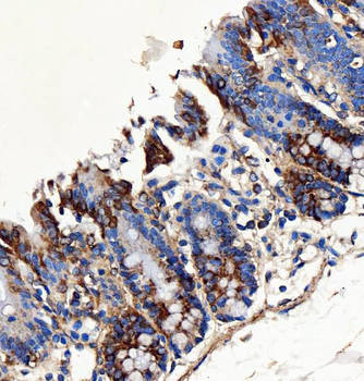 SH2D4A Antibody