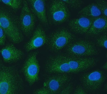 SH2D4A Antibody