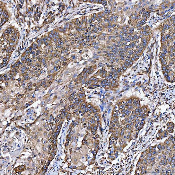 SH2D4A Antibody