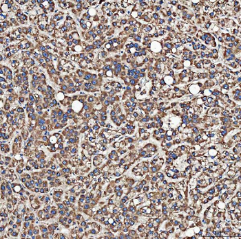 SH2D4A Antibody