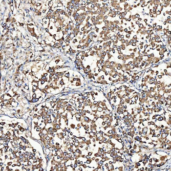 SH2D4A Antibody