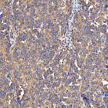 SH2D4A Antibody