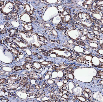 SH2D4A Antibody