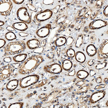 SH2D4A Antibody