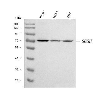 HSS/SGSH Rabbit Polyclonal Antibody