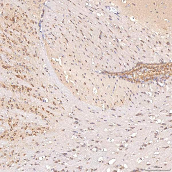 SGCE Rabbit Polyclonal Antibody