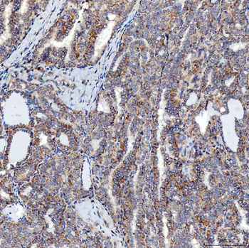 SFXN5 Antibody