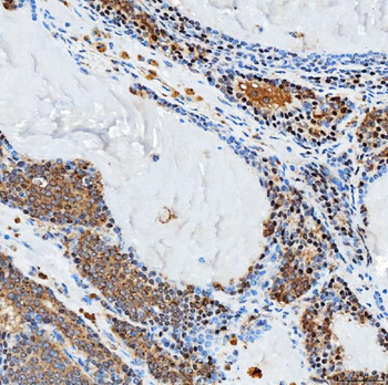 SFXN3 Antibody