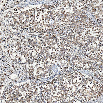SFXN3 Antibody