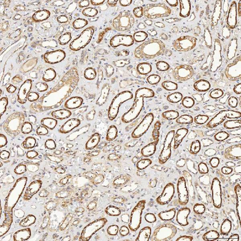 SFXN3 Antibody