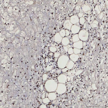 SF3B3 Antibody