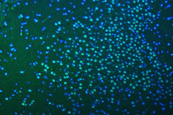 SF3B3 Antibody