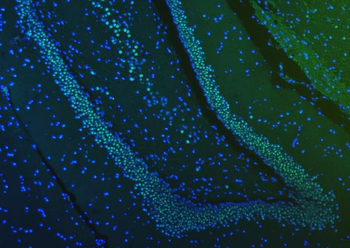 SF3B3 Antibody