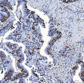 SF3B3 Antibody