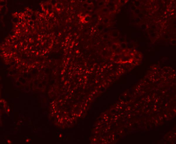 SF3A1 Antibody