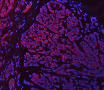SETD3 Antibody
