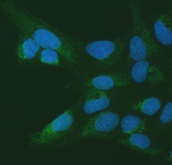 SETD3 Antibody