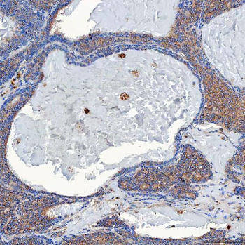 SETD3 Antibody