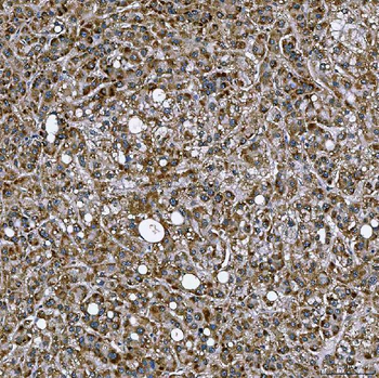 SETD3 Antibody