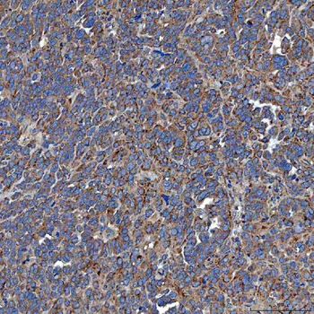 SETD3 Antibody