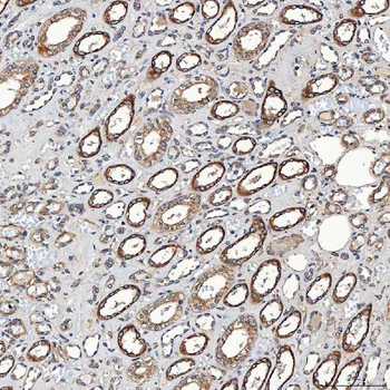 SETD3 Antibody