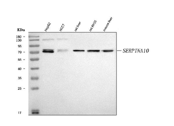 ZPI/SERPINA10 Rabbit Polyclonal Antibody