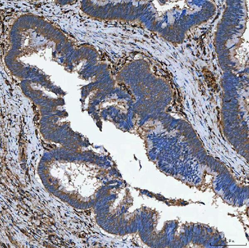 SEMA4F Antibody