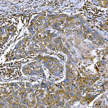 SEMA4F Antibody