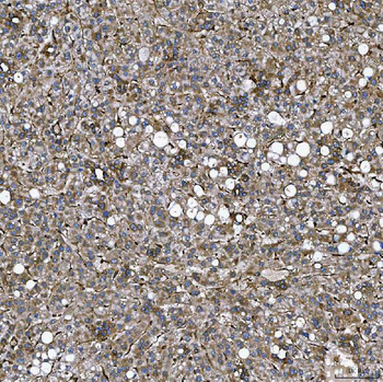 SEMA4F Antibody