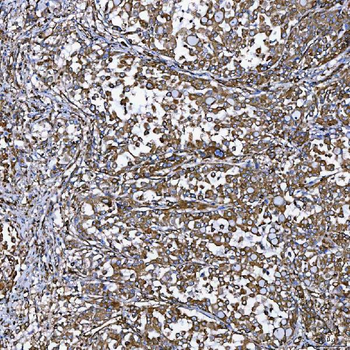 SEMA4F Antibody