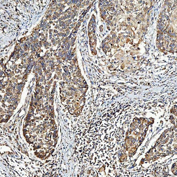 SELENOT Antibody