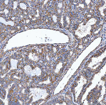SELENOT Antibody