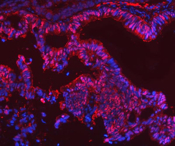 SBP/SELENBP1 Antibody