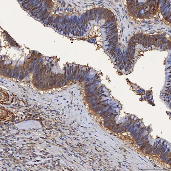 SBP/SELENBP1 Antibody