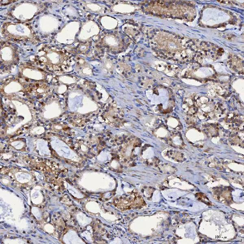 SBP/SELENBP1 Antibody