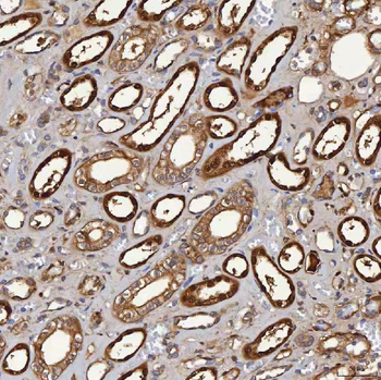SBP/SELENBP1 Antibody