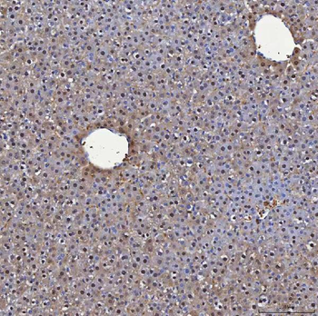 SBP/SELENBP1 Antibody