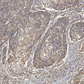 SEC23IP Antibody