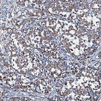 SEC23IP Antibody