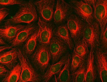 Syntenin 2/SDCBP2 Antibody