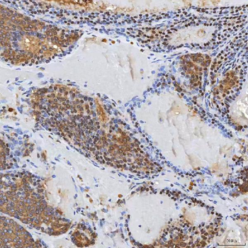 Syntenin 2/SDCBP2 Antibody