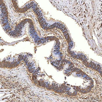 Syntenin 2/SDCBP2 Antibody